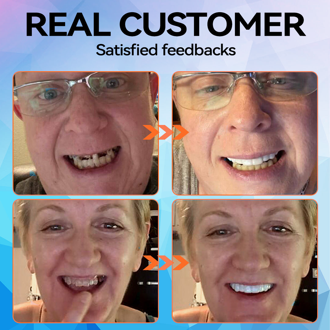Minceetbien™🗽 Silicone Reline Denture Set (⏰Limited Time 80% Off - Last 30 Minutes ⏰)