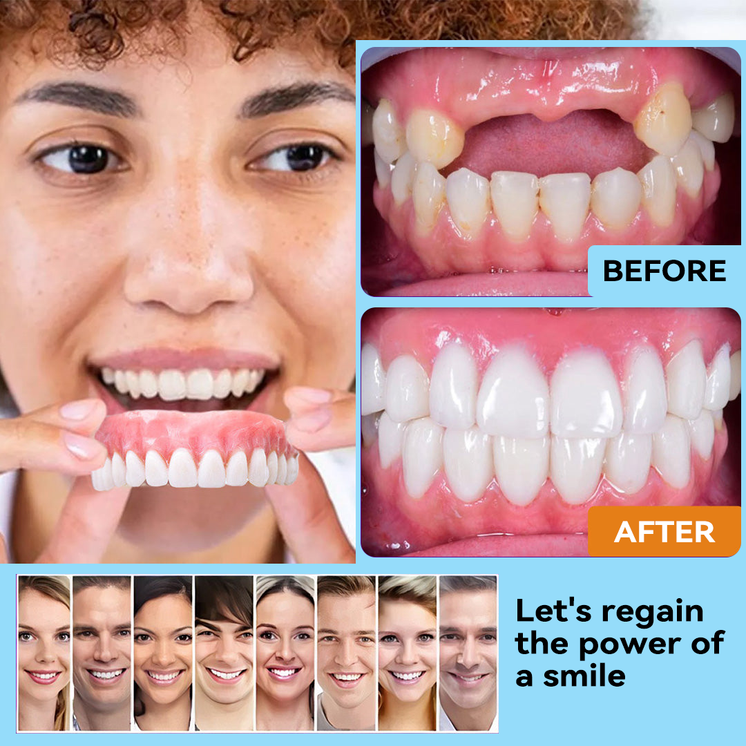 Minceetbien™🗽 Silicone Reline Denture Set (⏰Limited Time 80% Off - Last 30 Minutes ⏰)